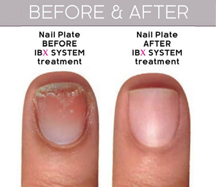 Fact-check: How does IBX Nail Strengthening Treatment Work? | Lab Muffin  Beauty Science