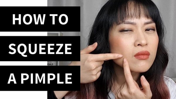 How to squeeze a pimple video thumbnail