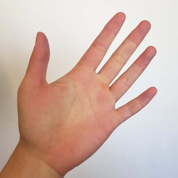 Hand after fake tan eraser