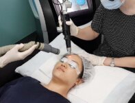 The Science of Laser Skin Treatments and Picosure Review (with video)