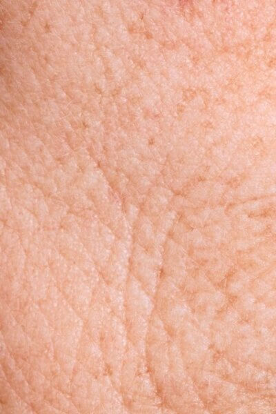 close up of aging skin