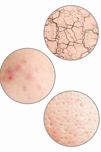 Different types of skin problems