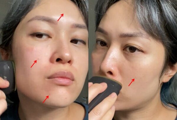 face spots passes sunscreen stick