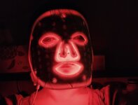 Is red light safe for hyperpigmentation and melasma?