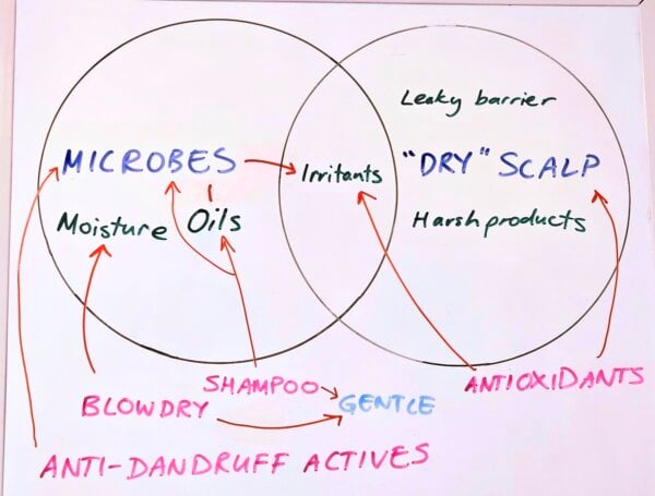 itchy scalp causes and treatments diagram