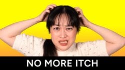 itchy scalp thumbnail