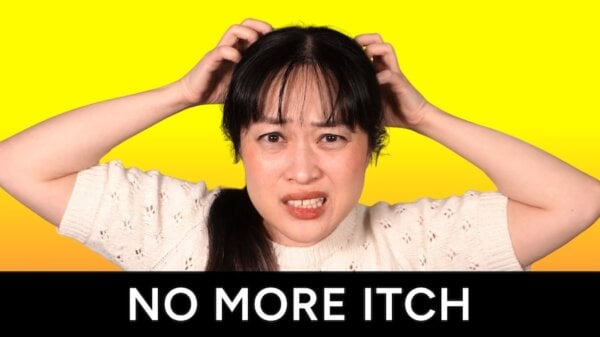 itchy scalp thumbnail